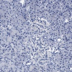 Anti-CNNM4 Antibody