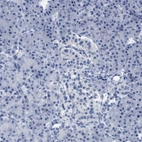 Immunohistochemical staining of human pancreas shows low expression as expected.