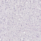 Immunohistochemical staining of human liver shows no positivity in hepatocytes as expected.