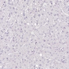 Immunohistochemical staining of human liver shows no positivity in hepatocytes as expected.