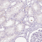 Immunohistochemical staining of human kidney shows no positivity in cells in tubules as expected.