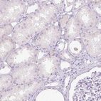 Immunohistochemical staining of human kidney shows no positivity in cells in tubules as expected.