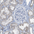 Immunohistochemical staining of human kidney shows weak cytoplasmic positivity in cells in tubules.