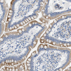 Anti-TEX264 Antibody