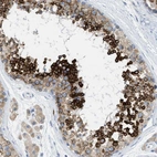 Immunohistochemical staining of human testis shows strong cytoplasmic positivity in cells in seminiferous ducts.