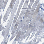 Immunohistochemical staining of human skeletal muscle shows no positivity in myocytes as expected.