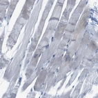 Immunohistochemical staining of human skeletal muscle shows no positivity in myocytes as expected.