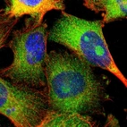 Immunofluorescent staining of human cell line U-251 MG shows localization to nucleoli & cytosol.