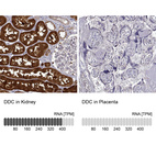 Anti-DDC Antibody