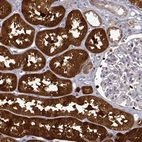 Immunohistochemical staining of human kidney shows strong cytoplasmic positivity in cells in tubules.