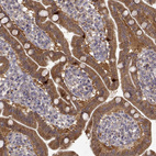 Immunohistochemical staining of human small intestine shows strong cytoplasmic positivity in glandular cells.