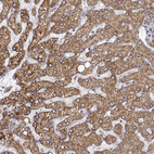 Anti-DDC Antibody