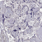 Immunohistochemical staining of human placenta shows no positivity in trophoblastic cells as expected.