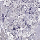 Immunohistochemical staining of human placenta shows no positivity in trophoblastic cells as expected.