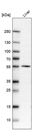 Western blot analysis in human liver tissue.