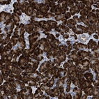 Immunohistochemical staining of human pancreas shows strong cytoplasmic positivity in exocrine glandular cells.