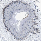 Immunohistochemical staining of human skin shows weak to moderate granular cytoplasmic positivity in stratum basale.