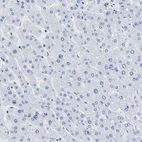 Immunohistochemical staining of human liver shows no cytoplasmic positivity in hepatocytes as expected.