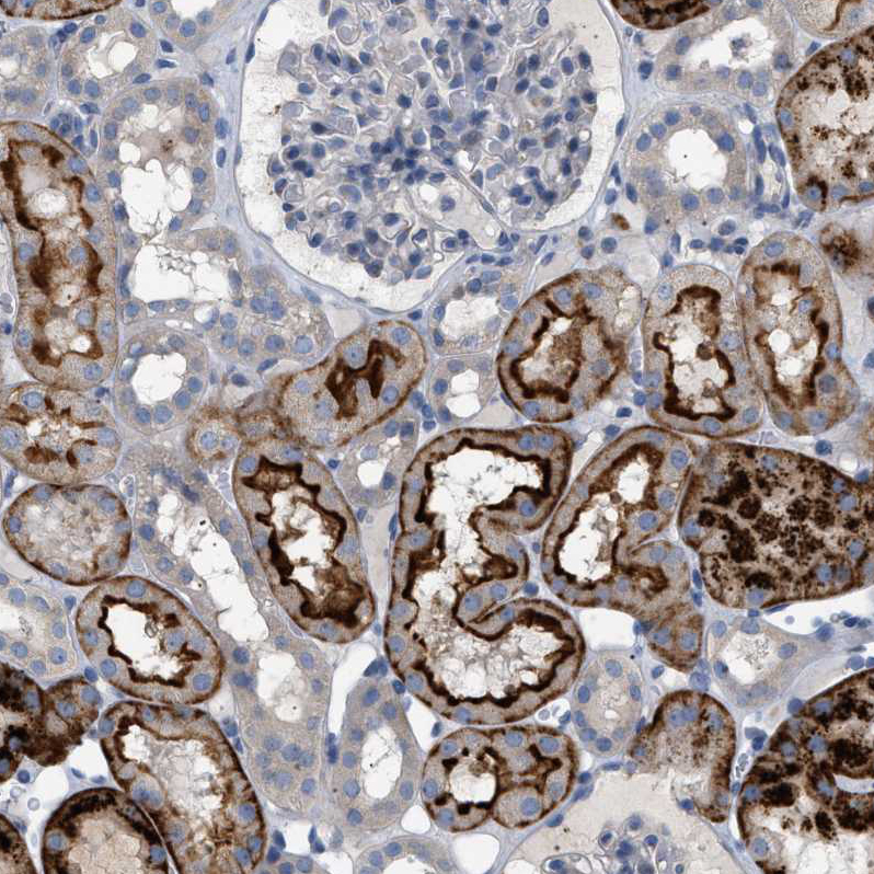 Anti-ADCY10 Antibody