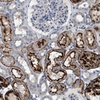 Anti-ADCY10 Antibody