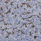 Immunohistochemical staining of human pancreas shows strong membranous positivity in subset of exocrine glandular cells.