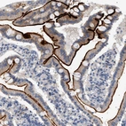 Immunohistochemical staining of human duodenum shows strong membranous positivity in glandular cells.