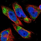 Immunofluorescent staining of human cell line U-251 MG shows localization to nucleoplasm & vesicles.