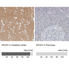 Anti-ATCAY Antibody