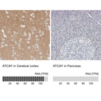 Anti-ATCAY Antibody