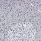 Anti-ATCAY Antibody