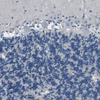 Immunohistochemical staining of human cerebellum shows no positivity in Purkinje cells as expected.