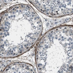 Immunohistochemical staining of human testis shows strong membranous positivity in peritubular myoid cells.
