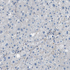 Anti-FBN1 Antibody