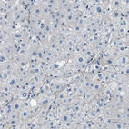 Immunohistochemical staining of human liver shows no positivity in hepatocytes, as expected.
