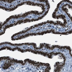 Immunohistochemical staining of human Fallopian tube shows strong nuclear positivity in glandular cells.