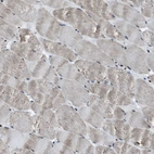 Immunohistochemical staining of human skeletal muscle shows weak nuclear positivity in myocytes as expected.