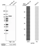 Western blot analysis in human cell lines SK-MEL-30 and Caco-2 using Anti-SLFN5 antibody. Corresponding SLFN5 RNA-seq data are presented for the same cell lines. Loading control: Anti-HDAC1.
