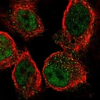 Immunofluorescent staining of human cell line A-431 shows localization to nucleoplasm & vesicles.