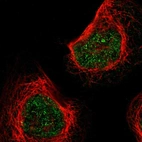 Immunofluorescent staining of human cell line A-431 shows localization to nucleoplasm.