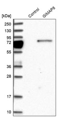Western blot analysis in control (vector only transfected HEK293T lysate) and GIMAP8 over-expression lysate (Co-expressed with a C-terminal myc-DDK tag (~3.1 kDa) in mammalian HEK293T cells, LY406278).