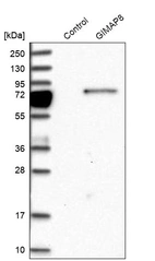 Western blot analysis in control (vector only transfected HEK293T lysate) and GIMAP8 over-expression lysate (Co-expressed with a C-terminal myc-DDK tag (~3.1 kDa) in mammalian HEK293T cells, LY406278).
