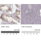 Anti-LY6K Antibody