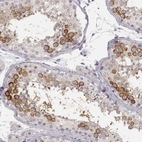 Immunohistochemical staining of human testis shows strong cytoplasmic positivity in cells in seminiferous ducts.