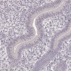 Immunohistochemical staining of human endometrium shows no positivity in glandular cells as expected.