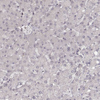 Immunohistochemical staining of human liver shows no positivity in hepatocytes as expected.