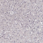 Immunohistochemical staining of human liver shows no positivity in hepatocytes as expected.