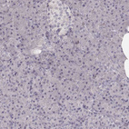 Anti-LY6K Antibody