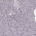 Immunohistochemical staining of human pancreas shows no positivity in exocrine glandular cells as expected.