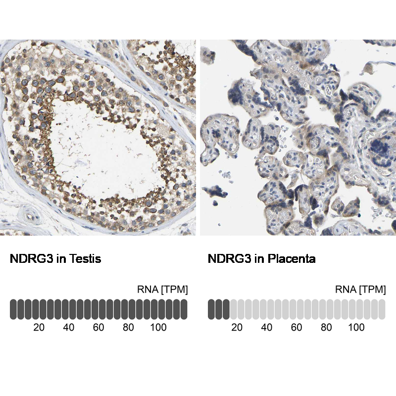Anti-NDRG3 Antibody