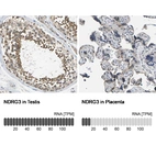 Anti-NDRG3 Antibody
